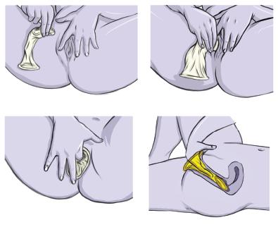 Инструкция, как одевать женский презерватив