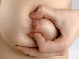 Выделения из груди при беременности